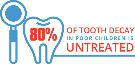 80% of tooth decay in poor children is untreated