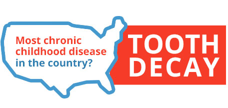 Most chronic childhood disease in the country is Tooth Decay